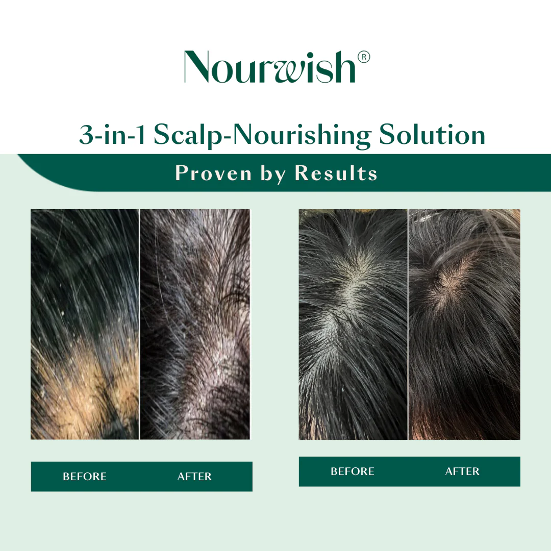 Nourwish Scalp Retreat Nourishing Scalp Serum