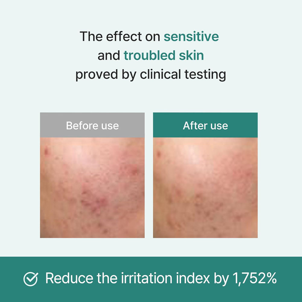 Im from Licorice Soothing Ampoule 30 ml