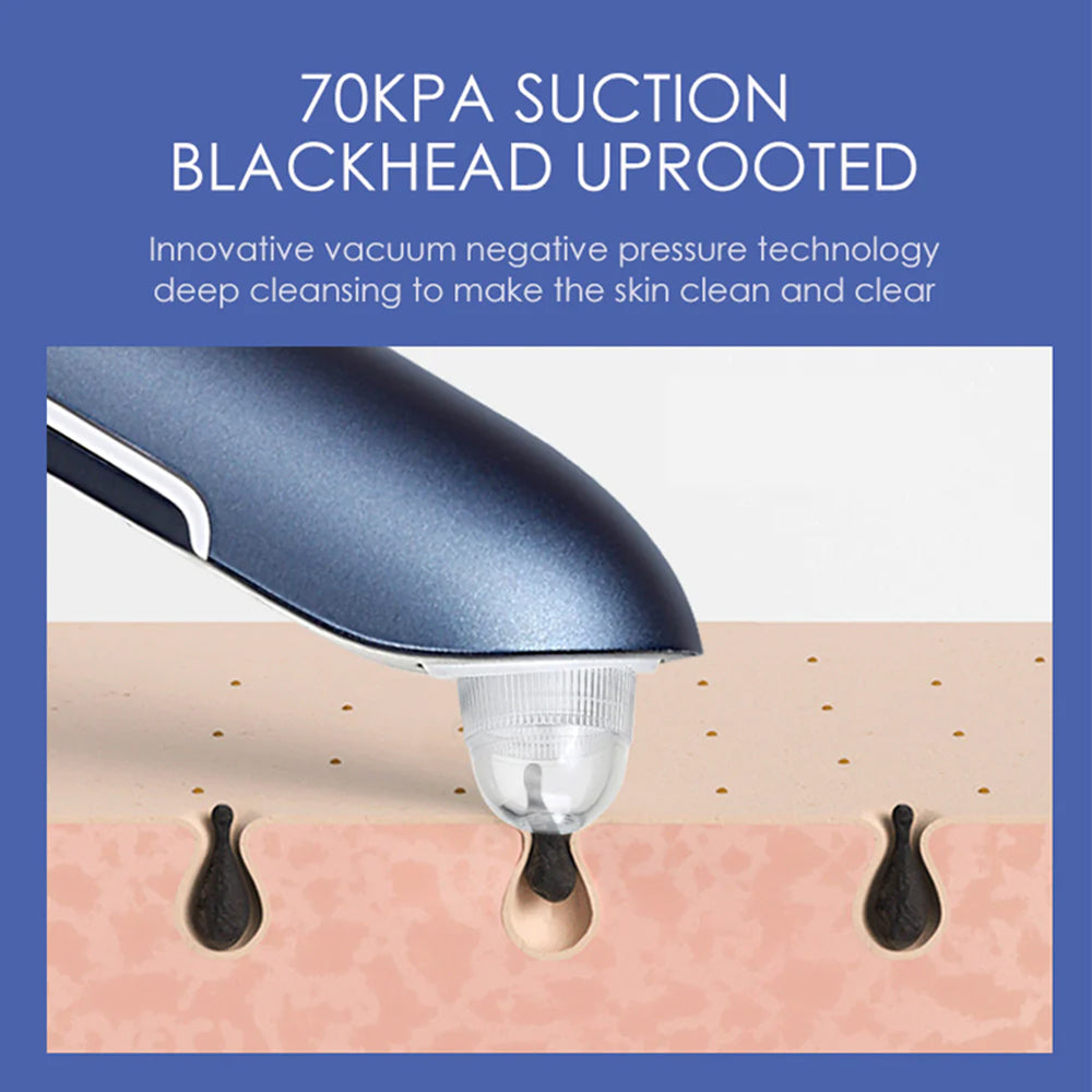 K Skin Blackheads Remover