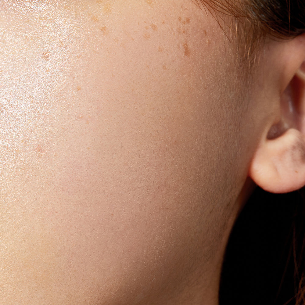 Cosrx The Niacinamide 15 Serum